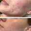 It Girl Skin – Skin Food