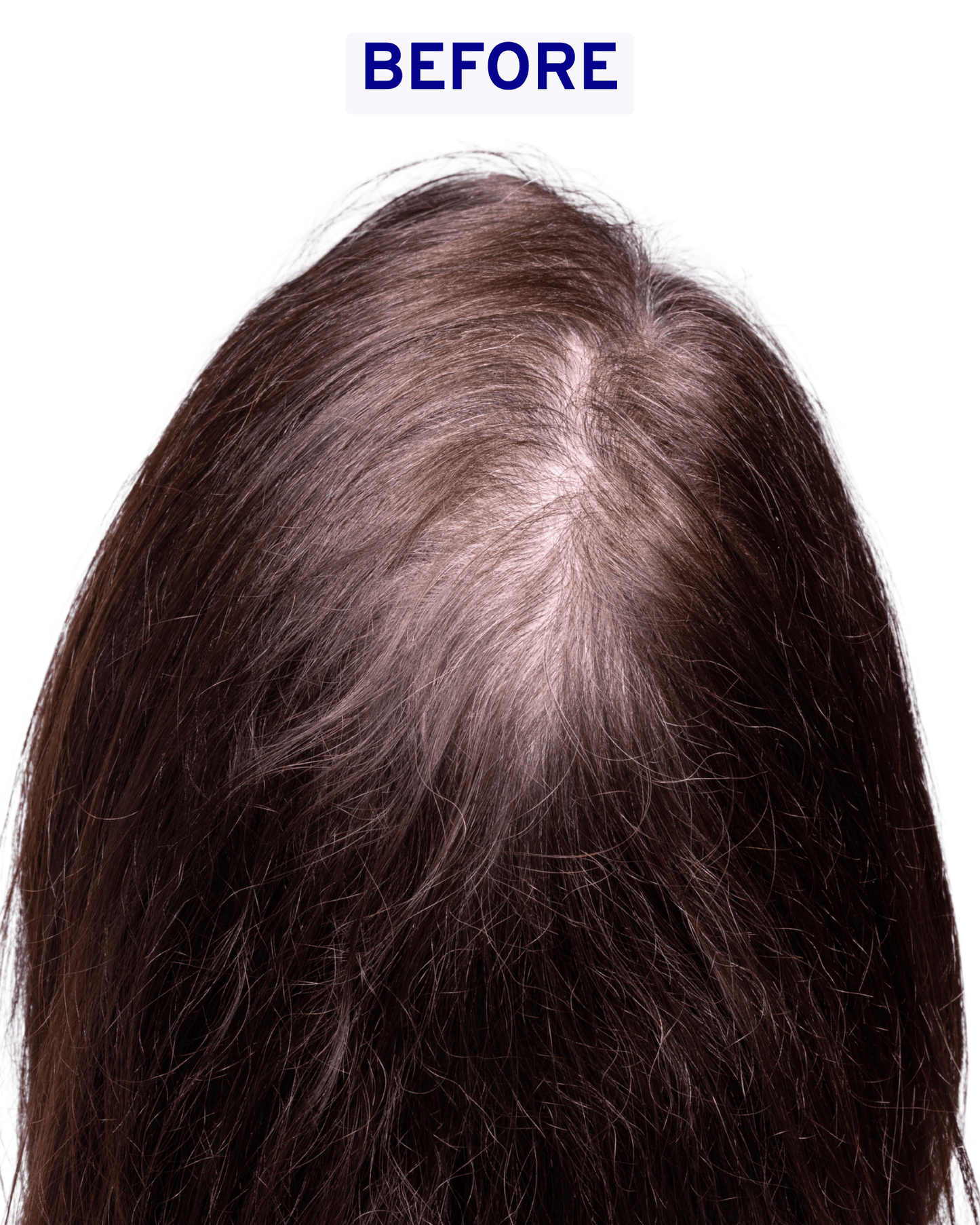 Hair & Scalp Serum | Hydration & Shine